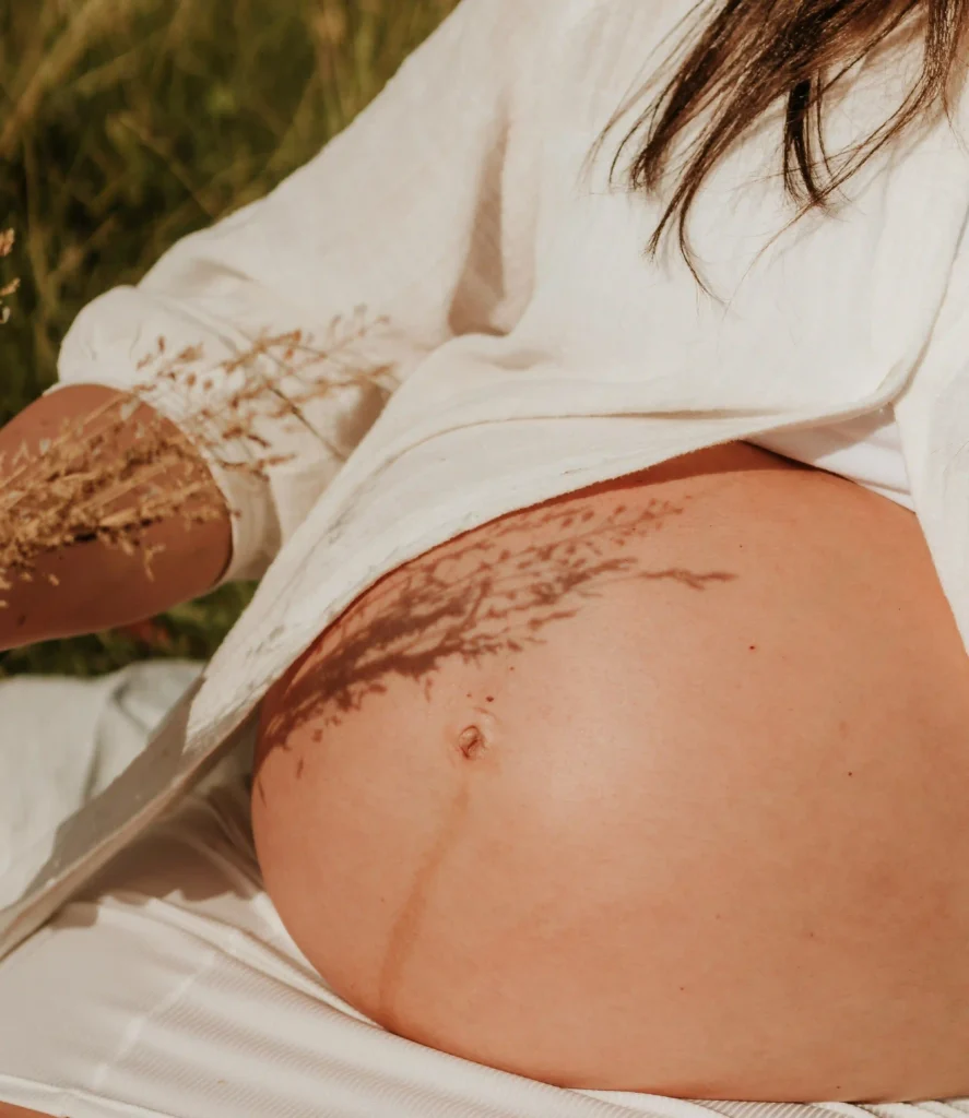 Acné adulto localizado en la mandíbula y el mentón, típico de desequilibrios hormonales.