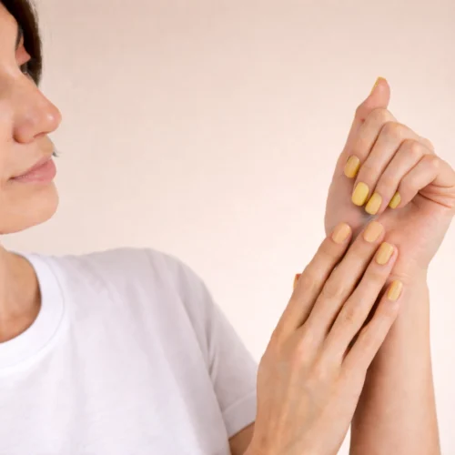 Uñas amarillas: 4 causas de porque suceden y cómo devolverles su brillo natural
