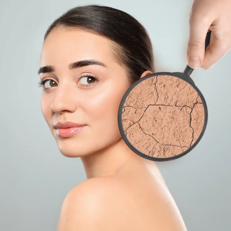 Piel seca: guía completa para entenderla, armar rutina y recuperar la barrera