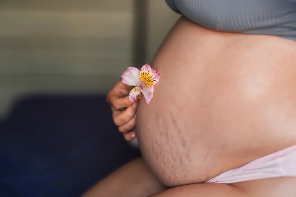 Abdomen de embarazada con estrías y una flor, mostrando la piel de forma natural.