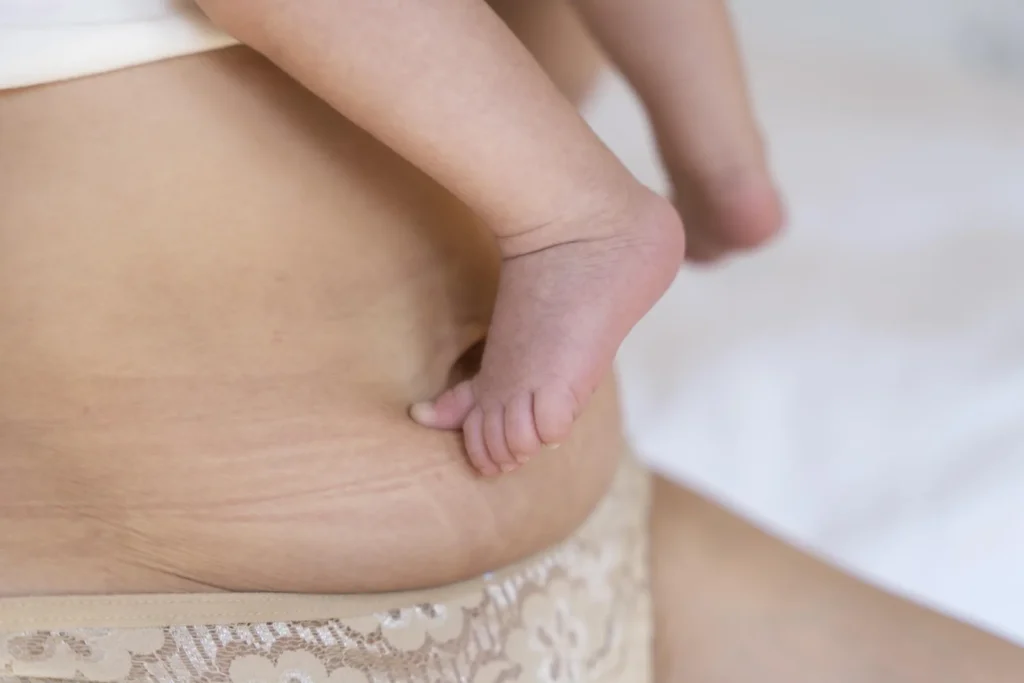 Pies de bebé recién nacido junto al abdomen de la madre en la etapa posparto.
